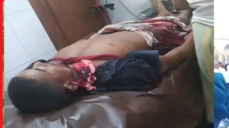 সাতকানিয়ায় কথা কাটাকাটির জেরে ছেলের ছুরিকাঘাতে বাবা খুন