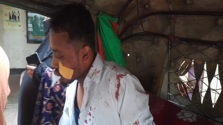 বোয়ালখালীতে কার-মোটরসাইকেল সংঘর্ষে আহত দুই...