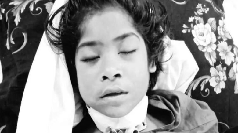 চট্টগ্রামে জঙ্গলে গলা কাটা সেই শিশুটি মারা গেছে