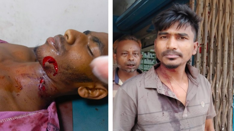 চাঁদাবাজিকে কেন্দ্র করে মিরসরাইয়ে দুই পক্ষের সংঘর্ষ, আহত ৫