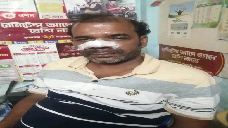 মরিচের গুঁড়ো ছুঁড়ে বিকাশ ব্যবসায়ীর টাকা ও মোবাইল লুট