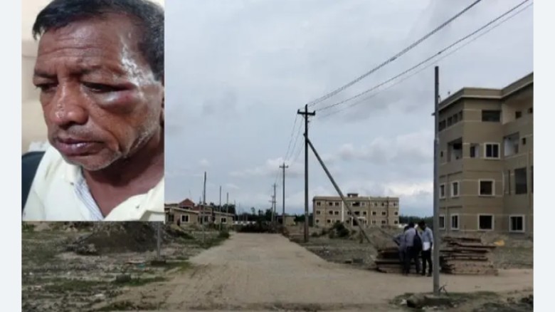 চট্টগ্রামে সিকিউরিটি ইনচার্জের ওপর ঠিকাদারের কর্মীদের হামলার