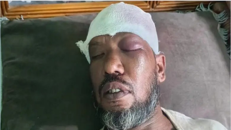পরকীয়ায় বাধা দেওয়ায় কৃষকের মাথা থেঁতলে দিল যুবক