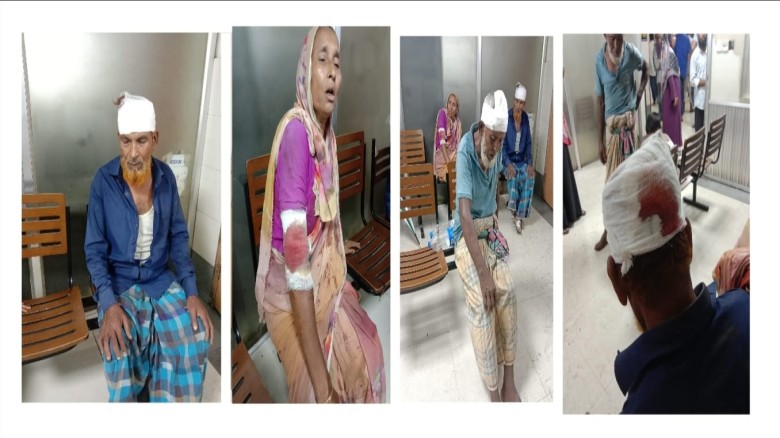 আনোয়ারায় লোহার রড ও দেশীয় অস্ত্র দিয়ে মারধরের অভিযোগ