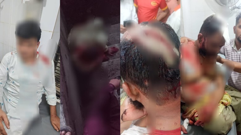 আনোয়ারায় মার্কেটের সামনে দোকান বসানো নিয়ে সংঘর্ষ, আহত ৭