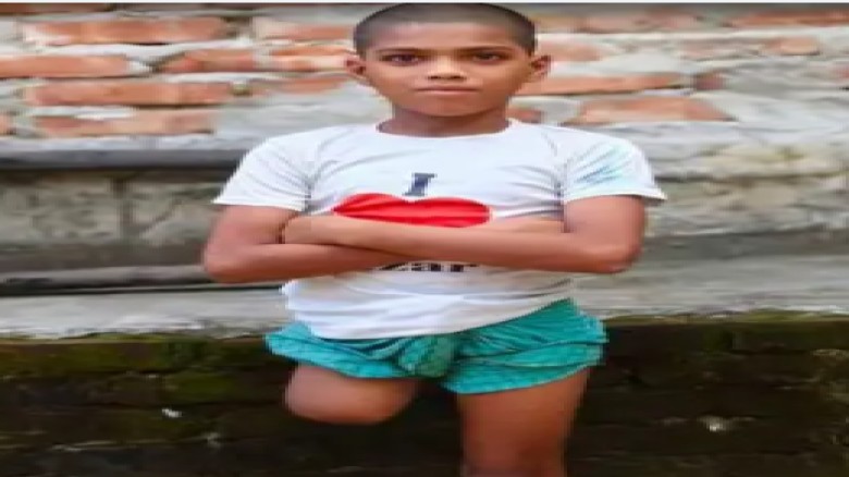 চুল কাটতে বের হওয়া রায়হান ফিরল এক পা ও কিডনি হারিয়ে